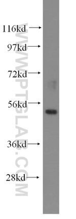 ZNF3 Antibody in Western Blot (WB)