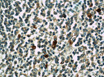 KLHL3 Antibody in Immunohistochemistry (Paraffin) (IHC (P))