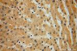 KLHL3 Antibody in Immunohistochemistry (Paraffin) (IHC (P))