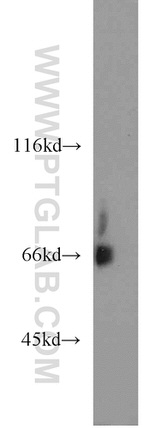 KLHL3 Antibody in Western Blot (WB)