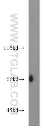 KLHL3 Antibody in Western Blot (WB)