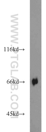 KLHL3 Antibody in Western Blot (WB)