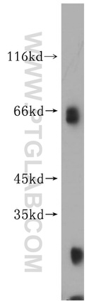 KLHL3 Antibody in Western Blot (WB)