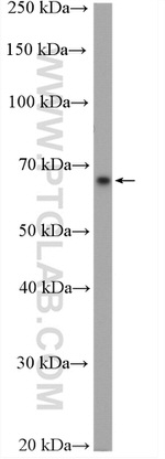 KLHL3 Antibody in Western Blot (WB)