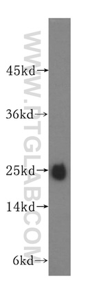 N6AMT2 Antibody in Western Blot (WB)