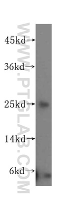 N6AMT2 Antibody in Western Blot (WB)