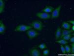 Connexin-26 Antibody in Immunocytochemistry (ICC/IF)