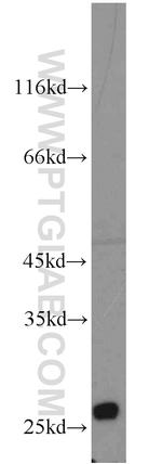 Connexin-26 Antibody in Western Blot (WB)