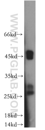 Connexin-26 Antibody in Western Blot (WB)