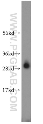 CA2 Antibody in Western Blot (WB)