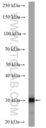 CA2 Antibody in Western Blot (WB)