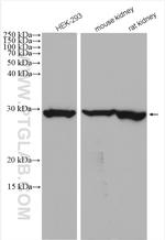 CA2 Antibody in Western Blot (WB)