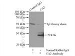 CA2 Antibody in Immunoprecipitation (IP)
