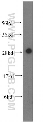 CA2 Antibody in Western Blot (WB)