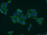 RPS5 Antibody in Immunocytochemistry (ICC/IF)