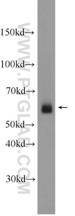 Frizzled 7 Antibody in Western Blot (WB)