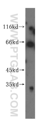 SGOL1 Antibody in Western Blot (WB)