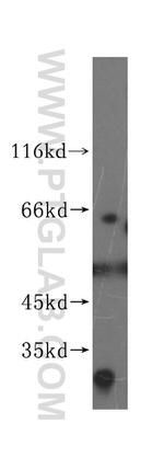 SGOL1 Antibody in Western Blot (WB)