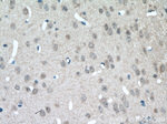 MGAT5B Antibody in Immunohistochemistry (Paraffin) (IHC (P))