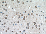 MGAT5B Antibody in Immunohistochemistry (Paraffin) (IHC (P))