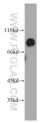 MGAT5B Antibody in Western Blot (WB)