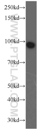 MGAT5B Antibody in Western Blot (WB)