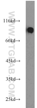 MGAT5B Antibody in Western Blot (WB)