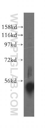 UFSP2 Antibody in Western Blot (WB)