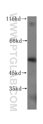 UFSP2 Antibody in Western Blot (WB)