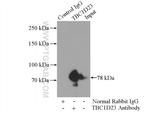 TBC1D23 Antibody in Immunoprecipitation (IP)