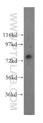 TBC1D23 Antibody in Western Blot (WB)