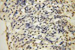 UCKL1 Antibody in Immunohistochemistry (Paraffin) (IHC (P))