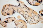 UCKL1 Antibody in Immunohistochemistry (Paraffin) (IHC (P))