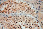 UCKL1 Antibody in Immunohistochemistry (Paraffin) (IHC (P))