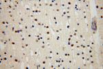 UCKL1 Antibody in Immunohistochemistry (Paraffin) (IHC (P))