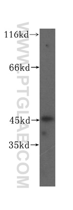 UCKL1 Antibody in Western Blot (WB)