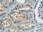 RECQL4 Antibody in Immunohistochemistry (Paraffin) (IHC (P))