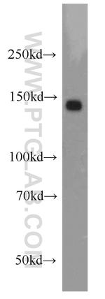 RECQL4 Antibody in Western Blot (WB)