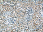 RECQL4 Antibody in Immunohistochemistry (Paraffin) (IHC (P))