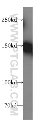 RECQL4 Antibody in Western Blot (WB)