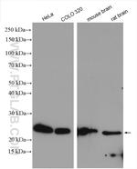 RPL10 Antibody in Western Blot (WB)