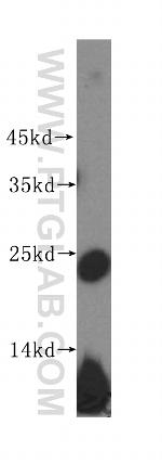 RPL10 Antibody in Western Blot (WB)