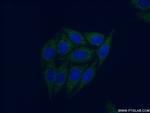 PPM1F Antibody in Immunocytochemistry (ICC/IF)