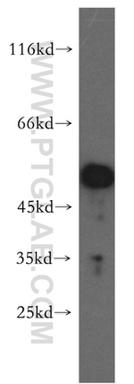 PPM1F Antibody in Western Blot (WB)