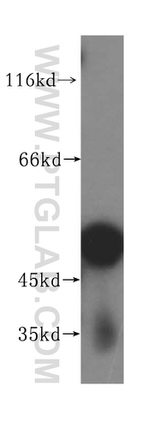 ACTR3B Antibody in Western Blot (WB)
