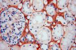 Collagen Type VI Antibody in Immunohistochemistry (Paraffin) (IHC (P))