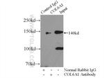 Collagen Type VI Antibody in Immunoprecipitation (IP)