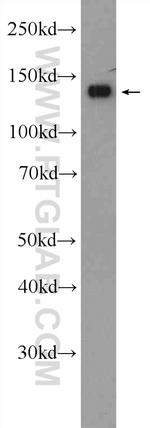 Collagen Type VI Antibody in Western Blot (WB)