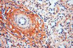 Collagen Type VI Antibody in Immunohistochemistry (Paraffin) (IHC (P))