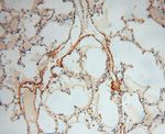 Collagen Type VI Antibody in Immunohistochemistry (Paraffin) (IHC (P))